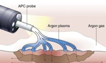 argon (1).png